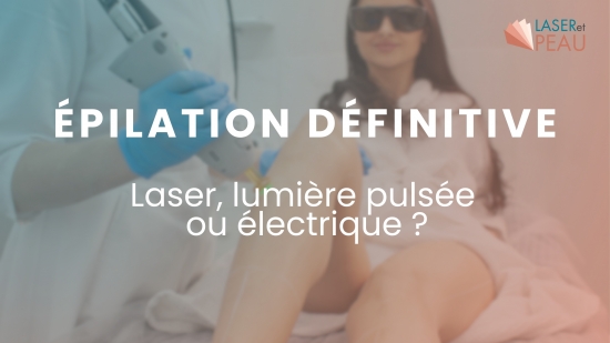 Épilation laser vs épilation électrique vs épilation à lumière pulsée - Quelle méthode choisir ?